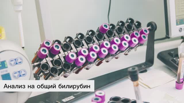 Анализ на общий билирубин