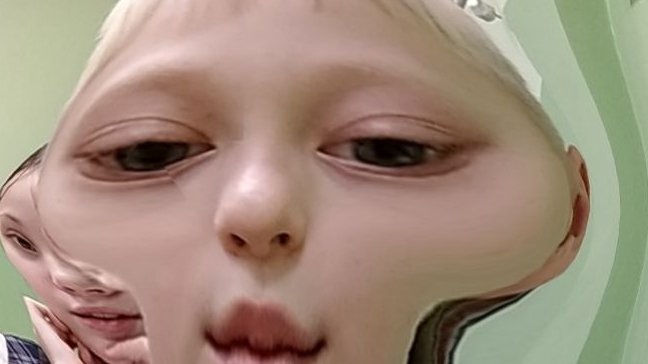 я