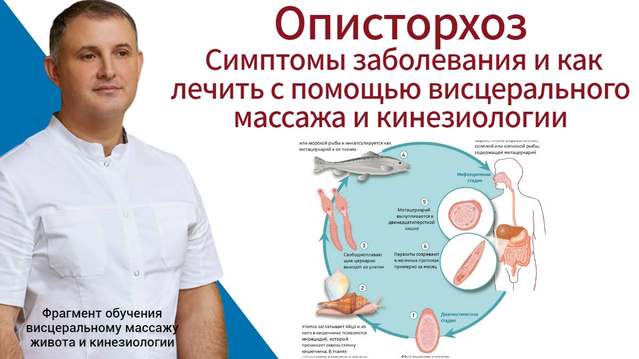 Описторхоз. Симптомы заболевания и как лечить с помощью висцерального массажа и кинезиологии.