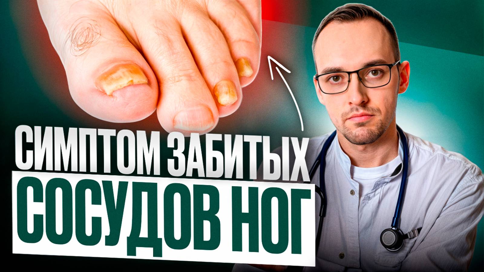 5 ПРИЗНАКОВ ЗАБИТЫХ СОСУДОВ НОГ