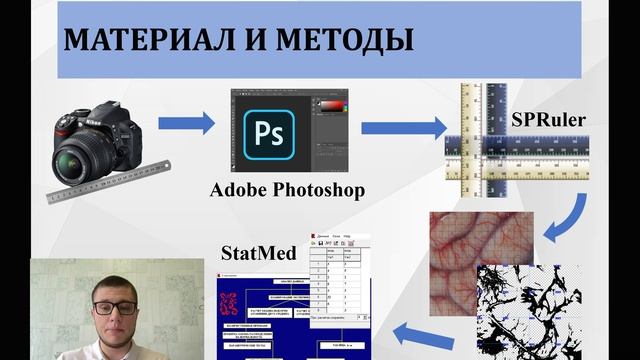 Половозрастные особенности величины индекса лакунарности ПАС полушарий головного мозга