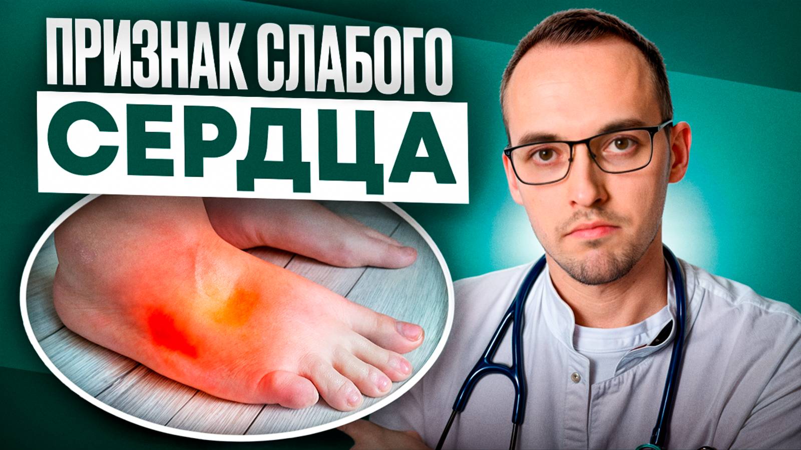 7 ПРИЗНАКОВ СЛАБОГО СЕРДЦА. Предотврати сердечную недостаточность, пока не поздно