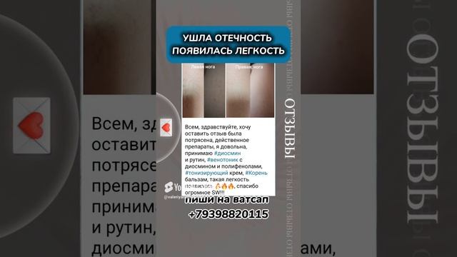 ушла отечность, появилась легкость.mp4