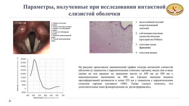 11. 5в. Ранняя диагностика опухолей гортани методом лазерной флуоресцентной спектроскопии.