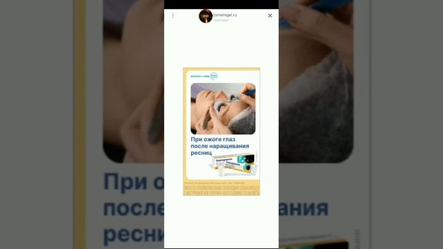 спрунки