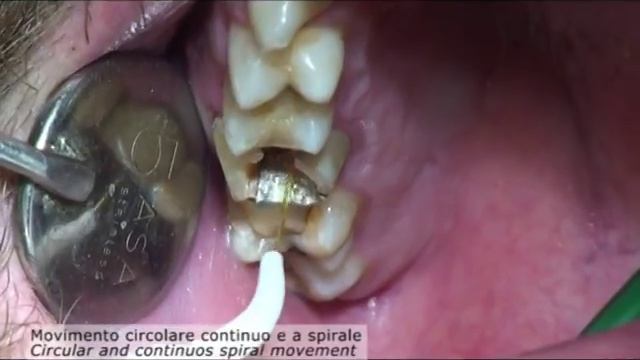 Endodontics