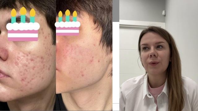 #Марафон 20.11 #день3.mp4