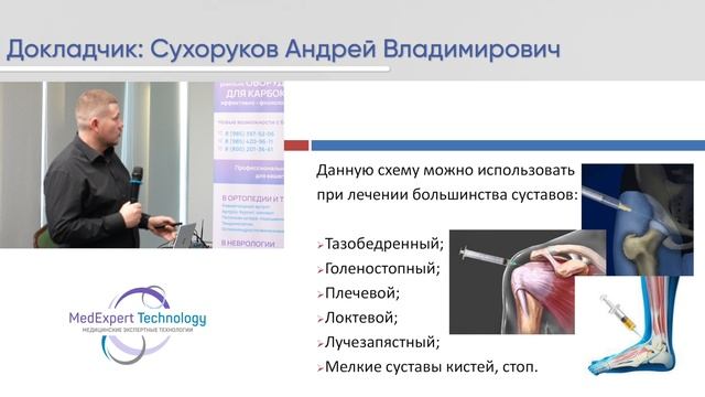 «Эффективные комбинации инъекционной карбокситерапии с prp