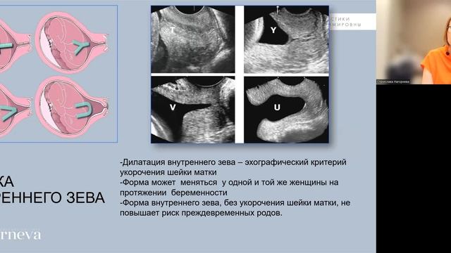 5.1 Лекция №9. Цервикометрия