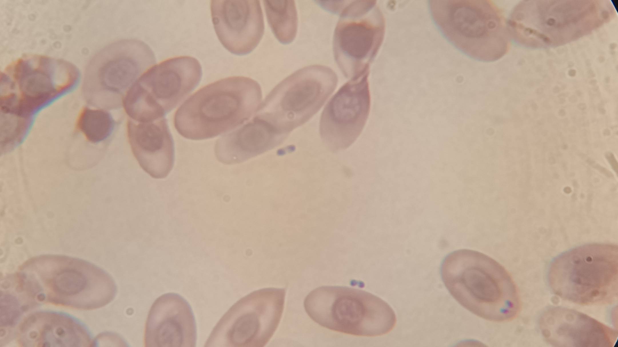 Новый выпуск по инфекциям птиц