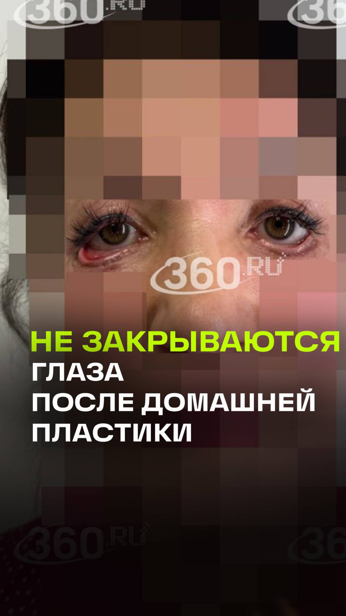 Москвичка не может закрыть глаза после неудачной пластики дома