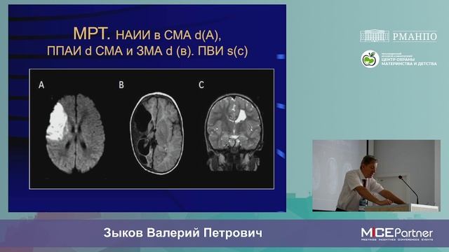 «Современные аспекты неонатальной церебральной ишемии» Зыков В. П.