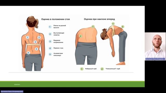 Сколиоз  Эффективные методики коррекции  Часть 3 Артемьев Павел Владимирович