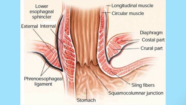 Signs and Symptoms Causes Investigations in Heart Burn Acid Reflux GERD