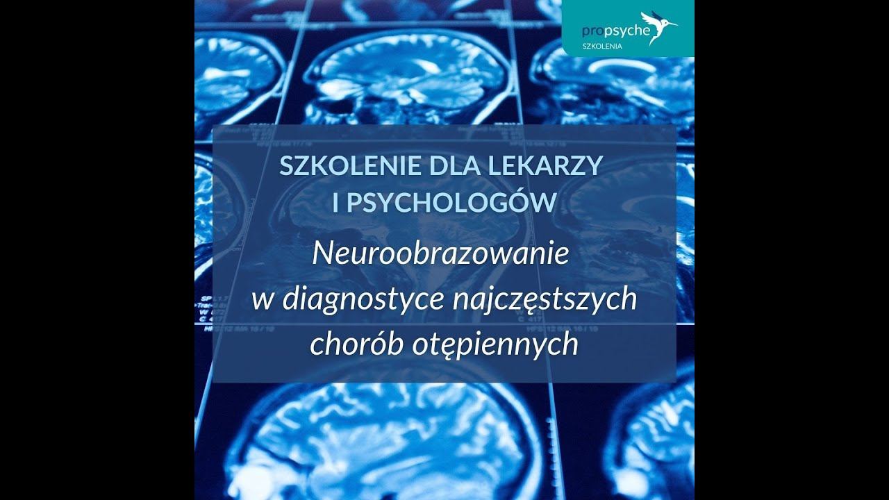Neuroobrazowanie w diagnostyce najczęstszych chorób otępiennych, szkolenie dla lekarzy i psychologó