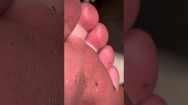 Dirty Feet 3