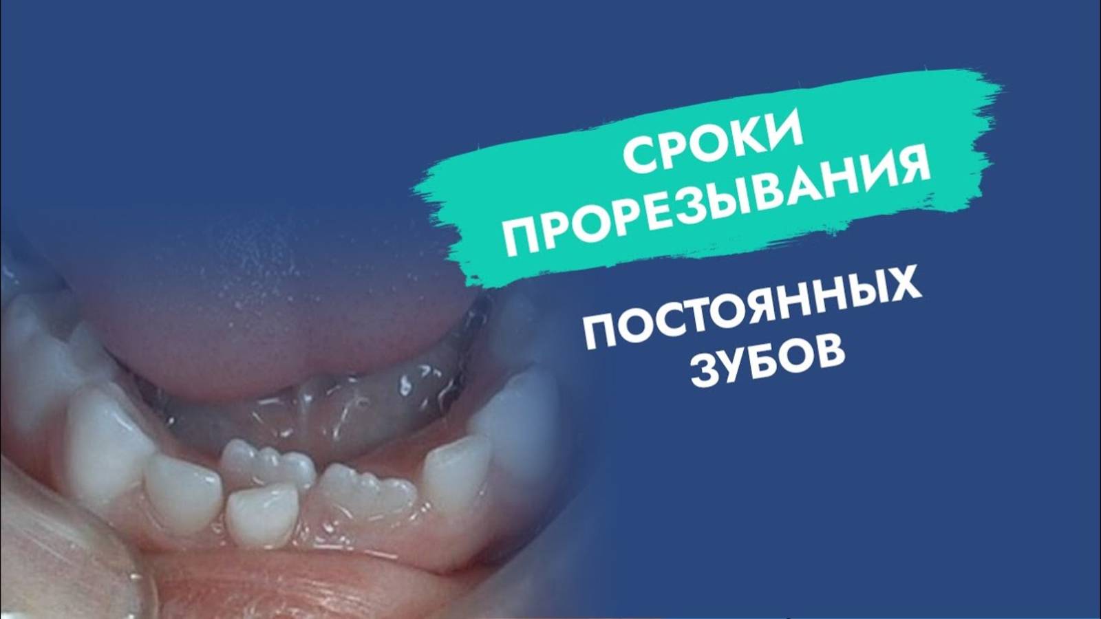 Как меняются молочные зубы на постоянные? То, что не все родители знают!