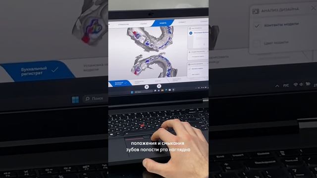 3D сканер в стоматологии #стоматологиякраснодар #брекеты #лечитьзубы #косметологкраснодар