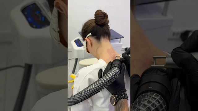 Удаление татуировки в SOKOLOV LASER🤩