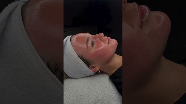Омоложение, очищение, увлажнение кожи без инъекций!