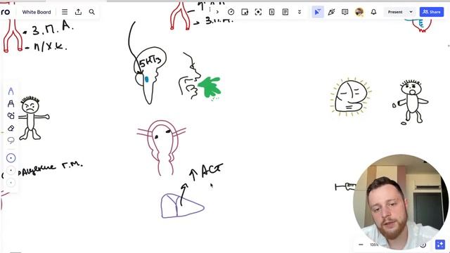 Наследие | Мигрени. Препараты: НПВП, стероиды, вальпроевая кислота, амитриптилин, эренумаб. Часть 4