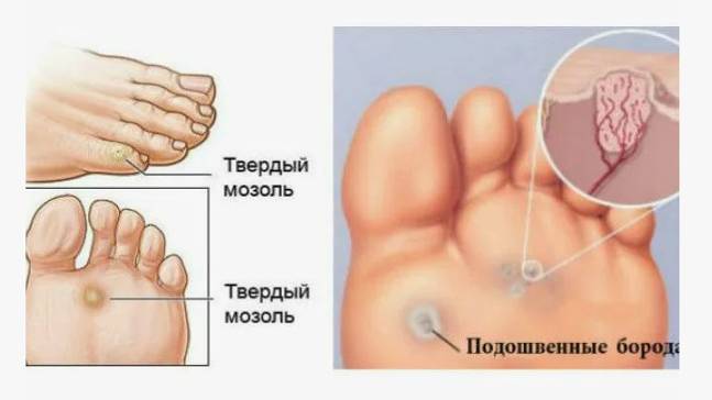 Эзотерический Метод Избавления от Бородавок _ Андрей Дуйко