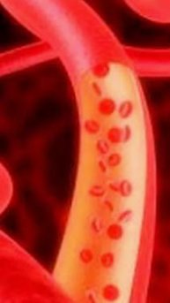 Как Помочь Своим Сосудам Поможет упражнение от йогов