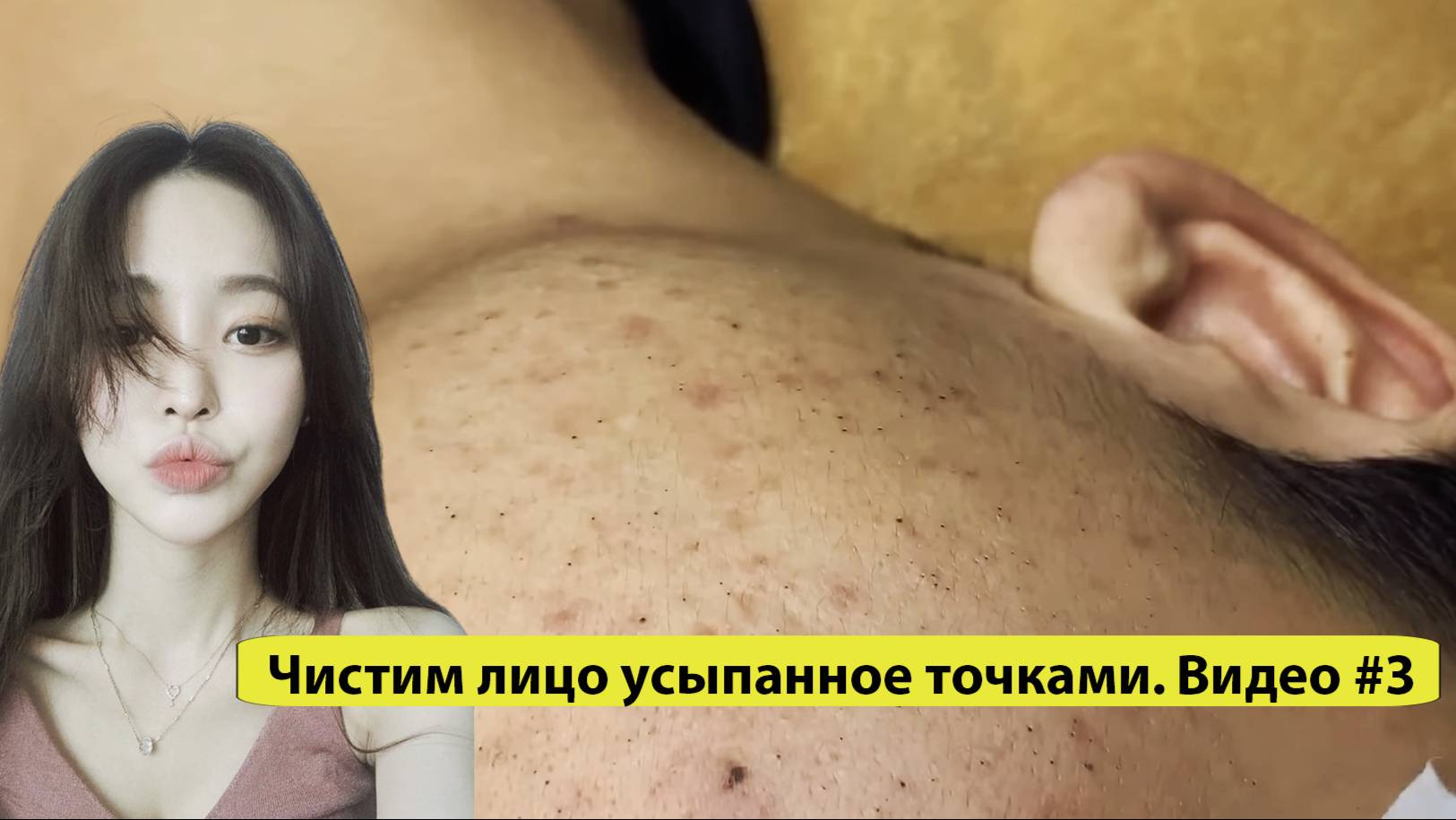 Чистим лицо усыпанное точками. Видео №3