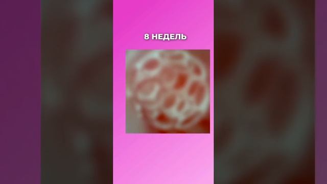 А вы знаете, как видят мир новорожденные малыши?