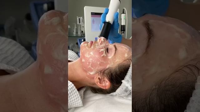 Голливудский уход Geneo+, Джинео