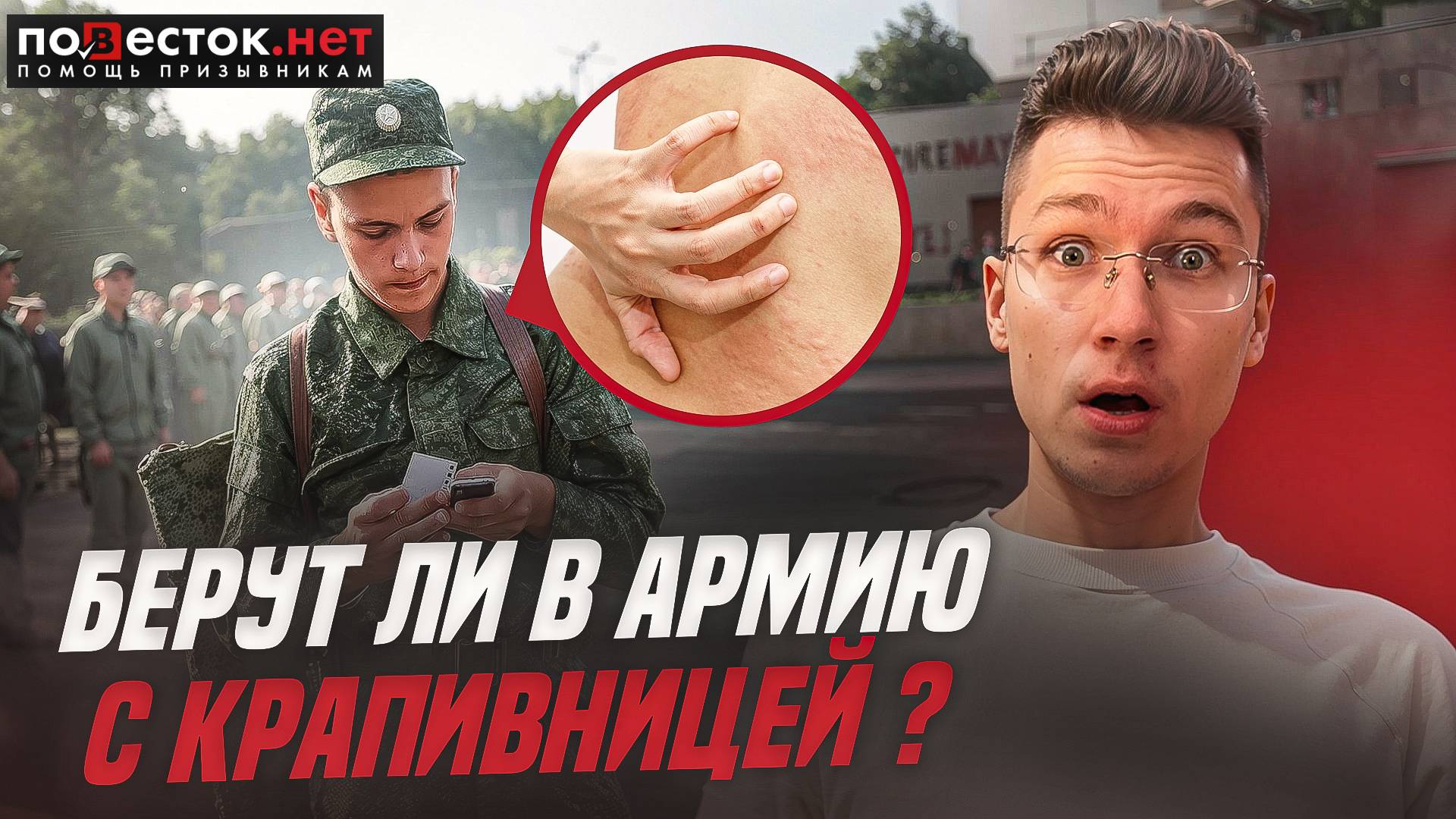 Берут ли в армию с крапивницей? Повесток.нет