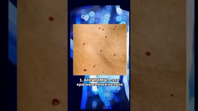 ПЕЧЕНЬ УМИРАЕТ МОЛЧА