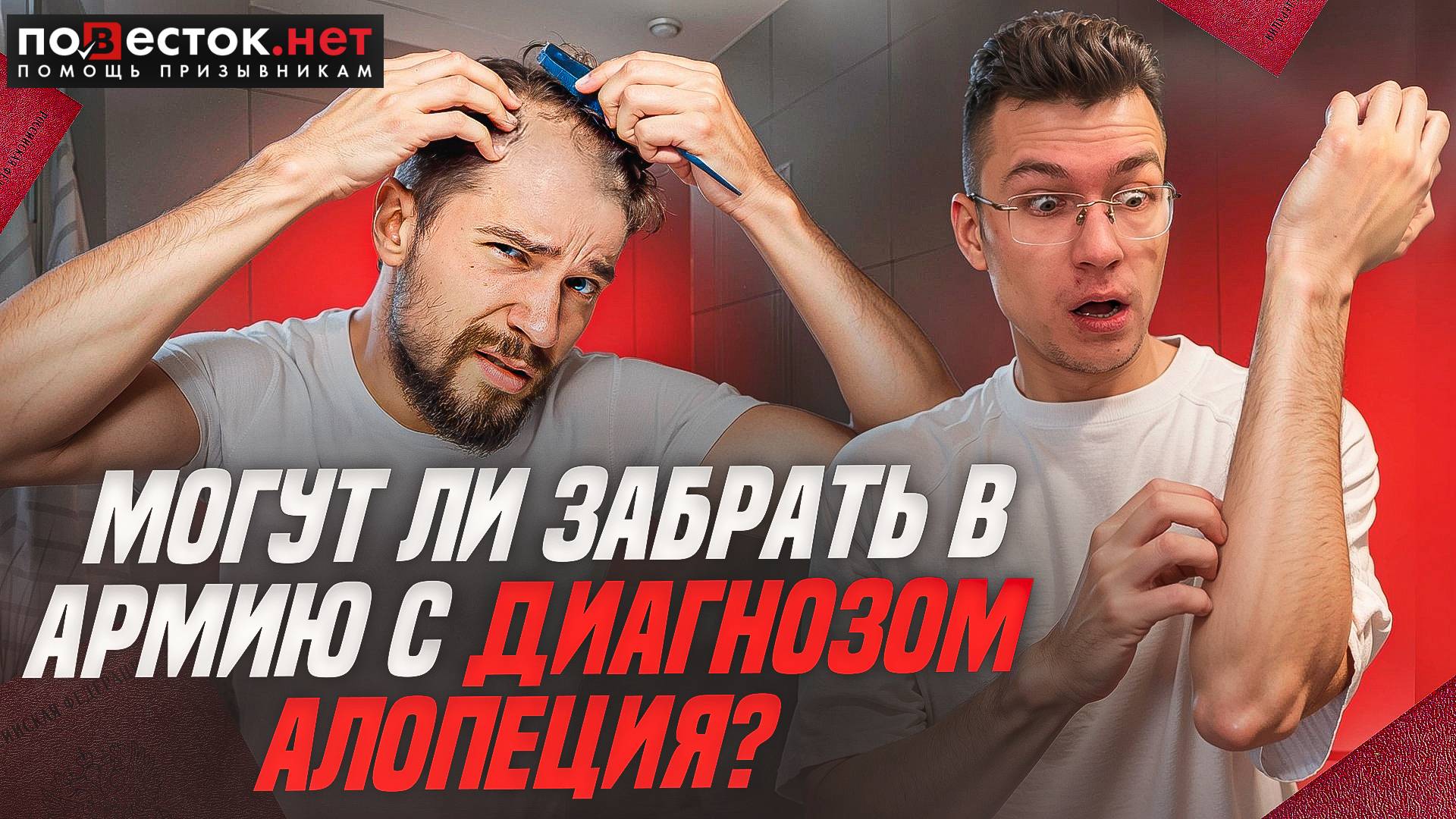 Берут ли в армию с алопецией? Повесток.нет