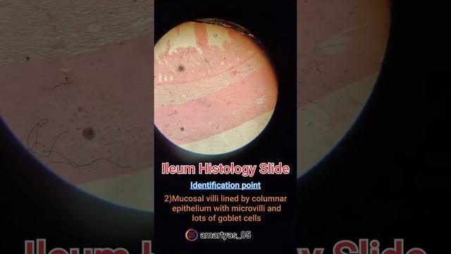 Ileum  | Histology Slides | Karwar institute of medical sciences