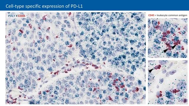 Characterization of immune checkpoint expression & infiltrating immune cells in TME by RNAscope ISH