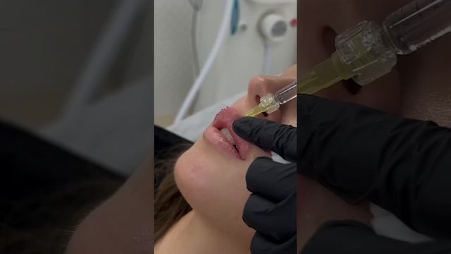 Наши пациенты самые красивые! ❤️