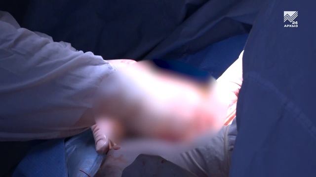 Хирурги Карачаево-Черкесии спасли жизнь пациенту с разрывом аорты