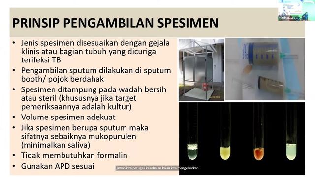 KULIAH TAMU "ATLM yang Kompeten Untuk Eliminasi TB 2030"