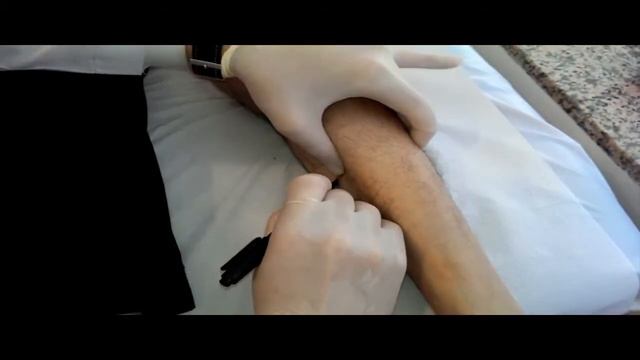 botox final