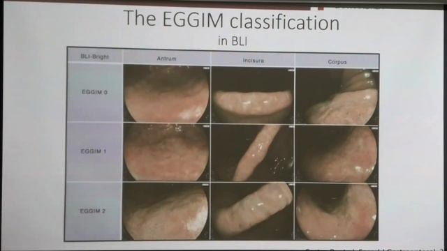 2024 06 22 Гастро06 Gianluca Esposito Endoscopic staging of gastritis the EGGIM system