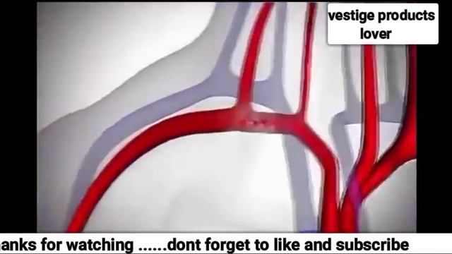 Vestige Curcumin Plus का कामाल देखिये / Curcumin Health Benefits
