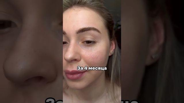 #4месяца #результат Если у тебя не так #задумайся #яжду #дерматолог #Яврач.mp4