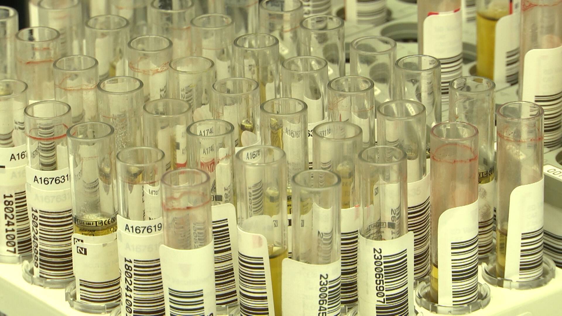 ВИЧ НА КАМЧАТКЕ