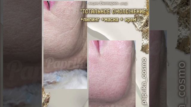 1000089633.mp4