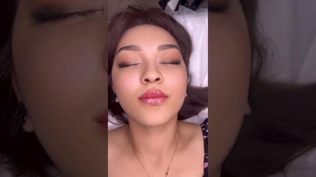 Очень естественное увеличение губ 💋