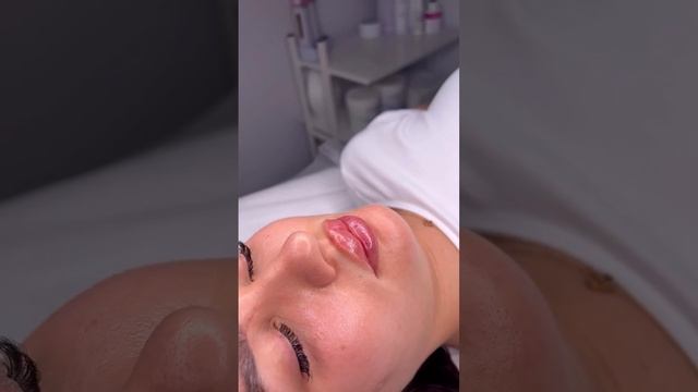 Аугментация губ🫦 как Симфония женственности