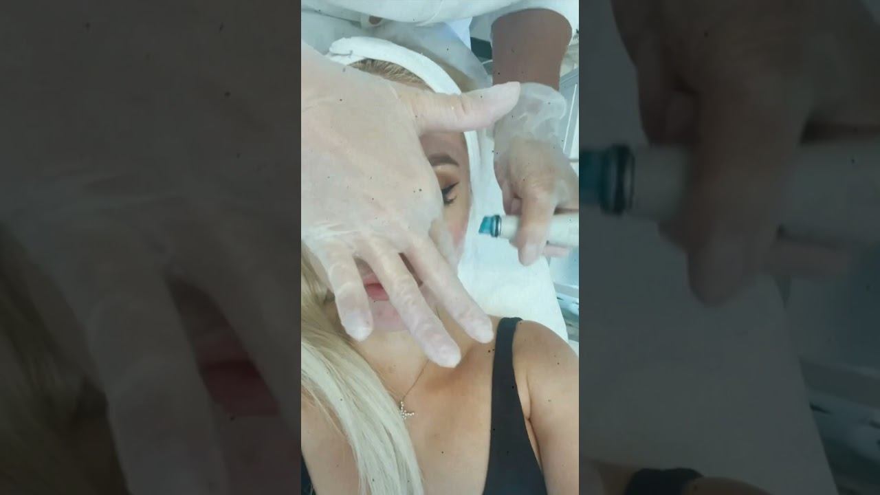 Милана Тюльпанова в Venesa Clinic (процедура Hydrafacial)