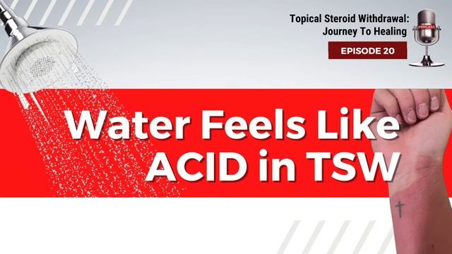 Water Feels Like Acid in TSW