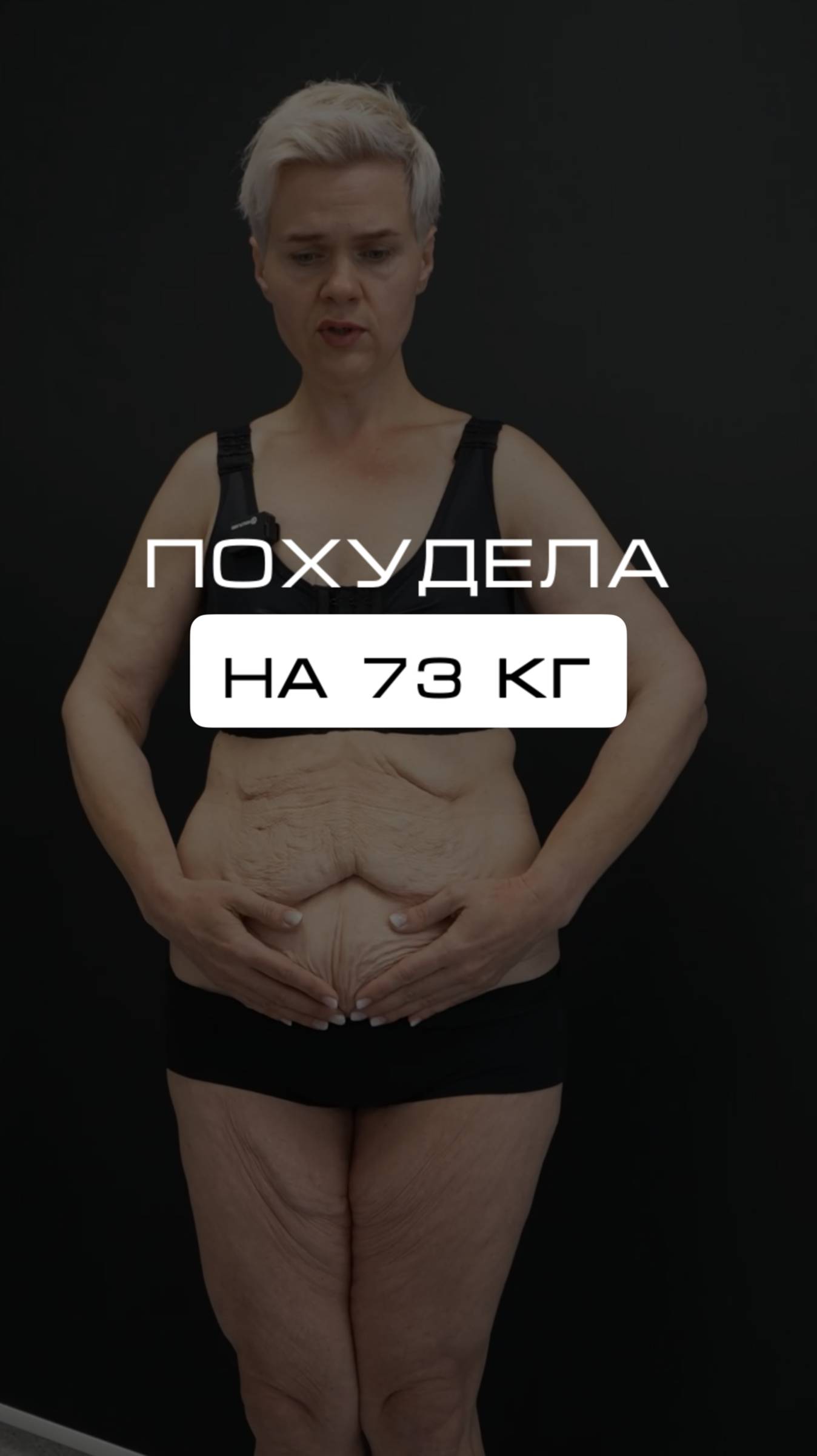 Похудела на 73 кг: как Ольга решилась на пластическую операцию?