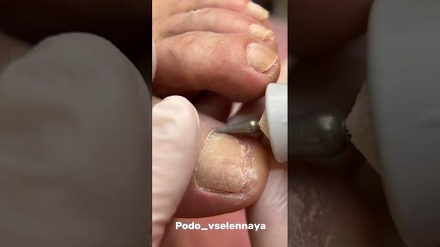 Классический педикюр.